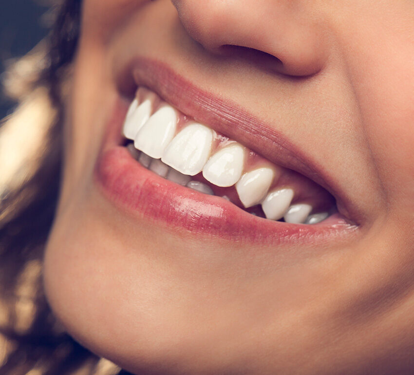 Ortodoncia_estética