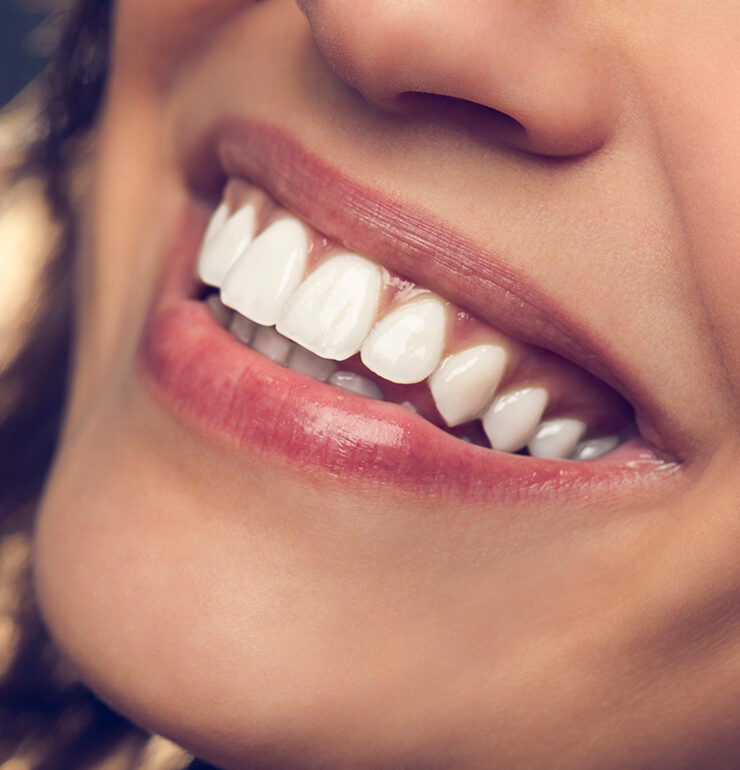 Ortodoncia_estética